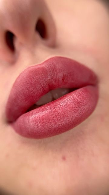 توريد الشفاه Result Dubai