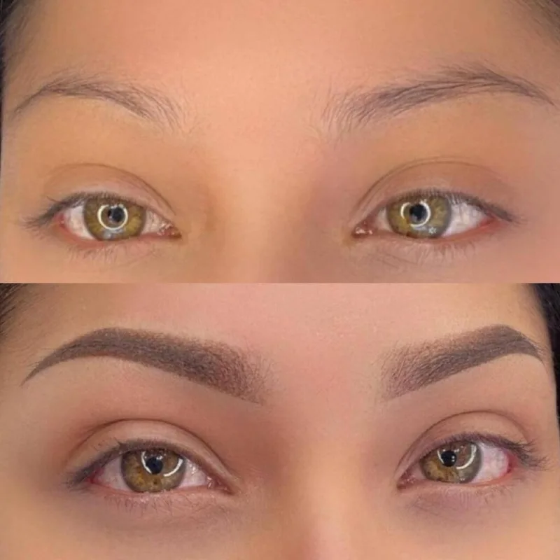 Brow Before & After