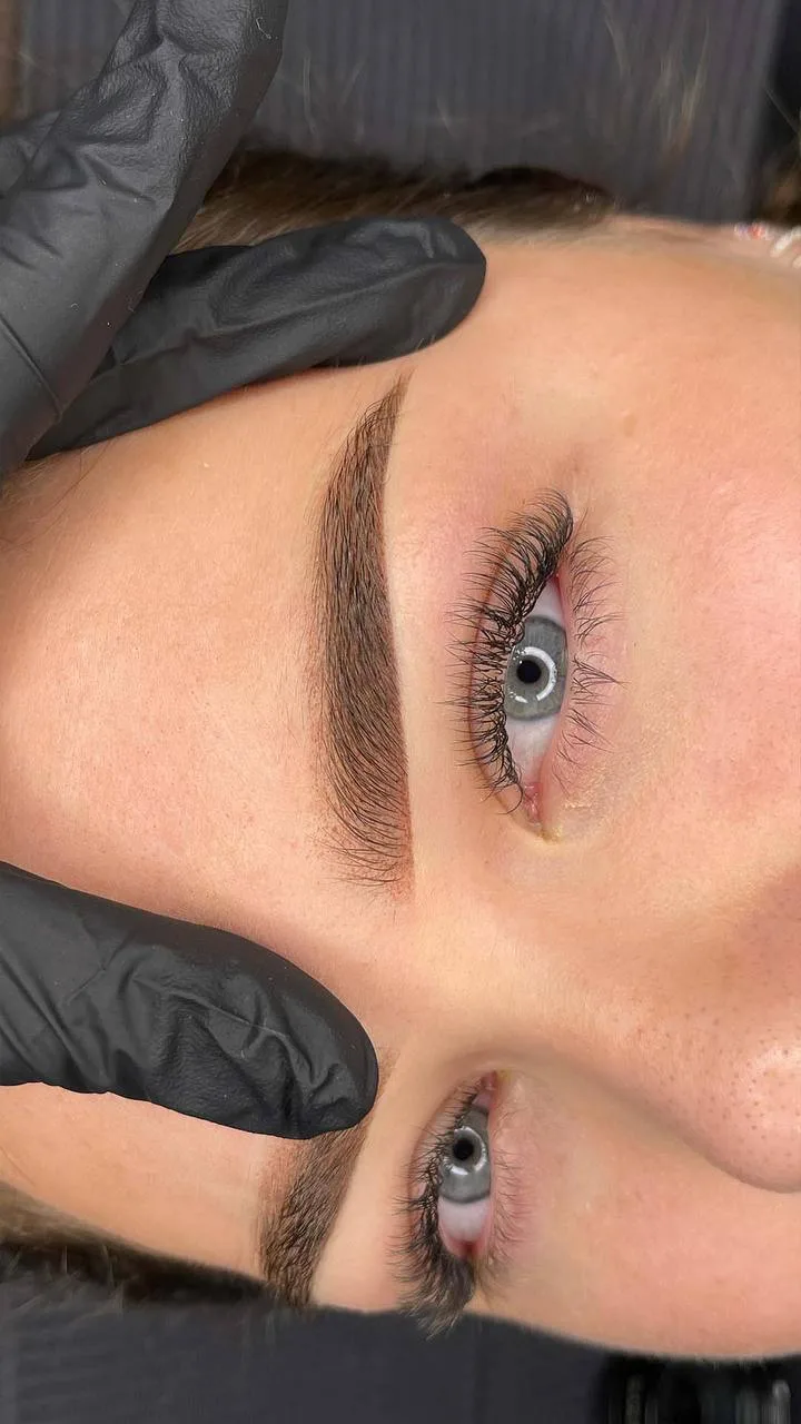 Brow Procedure