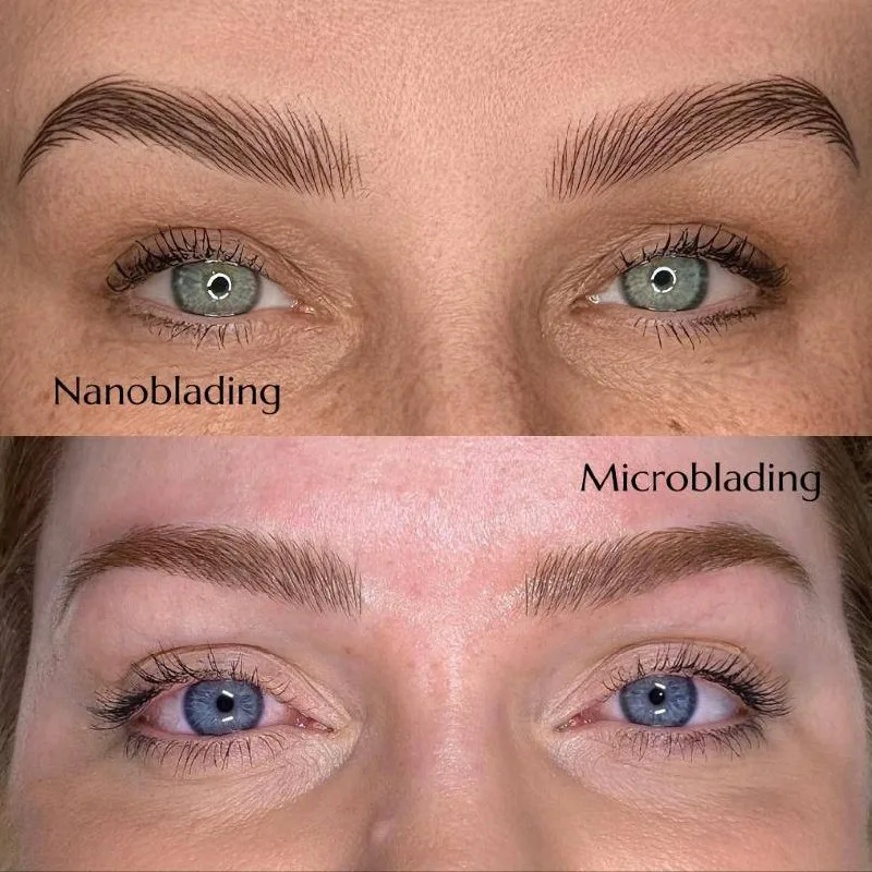 Nanoblading vs Microblading